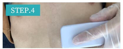 胸毛脱毛Step4
