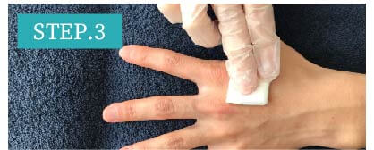 手の甲脱毛Step3