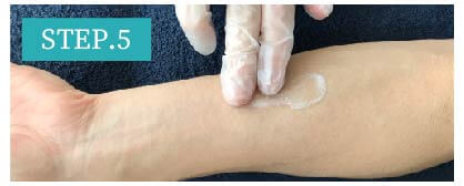 手の甲脱毛Step5