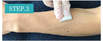 陰嚢部脱毛Step3