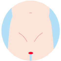 Iライン